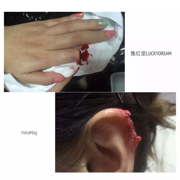 断指与断耳